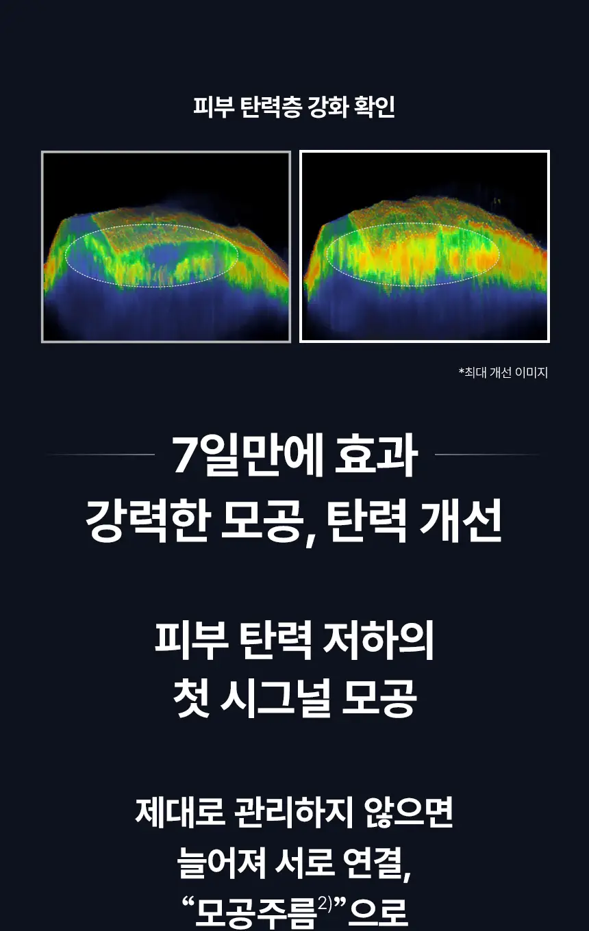 [자극도0.0/입문레티놀] 아이오페 레티놀 슈퍼 바운스 세럼 30ml +25ml 기획 상세페이지 12